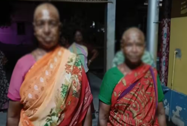 சேலம் அருகே புதுவித நோய் எனக் கூறி மோசடி; ரூ.15,000 ஊக்கத்தொகை ஆசையில் 3 பெண்கள் மொட்டை அடித்த சோகம்